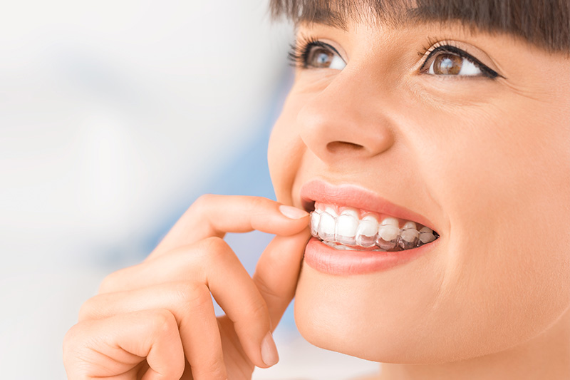 Invisalign in Matawan